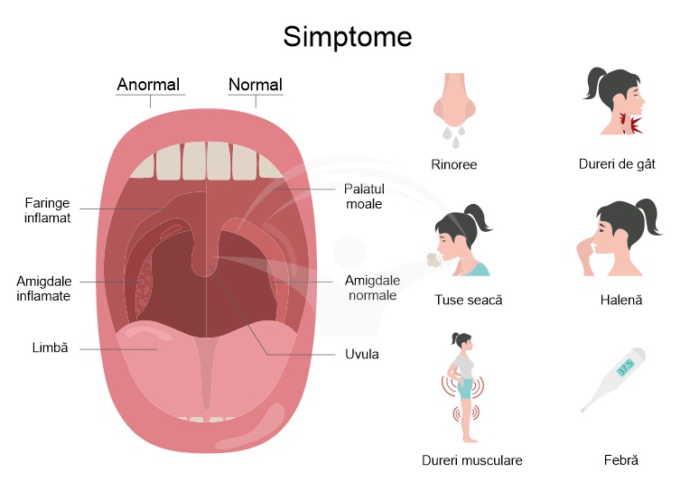 Infectia cu stafilococ – simptome, diagnostic, tratament