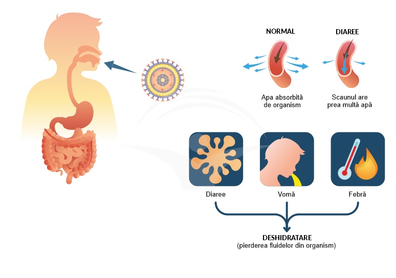 nut Eco friendly Generally speaking Infectia cu Rotavirus-simptome, investigatii si tratament