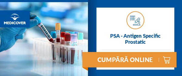 PSA total (antigen specific prostatic) - Detalii analiza | Bioclinica
