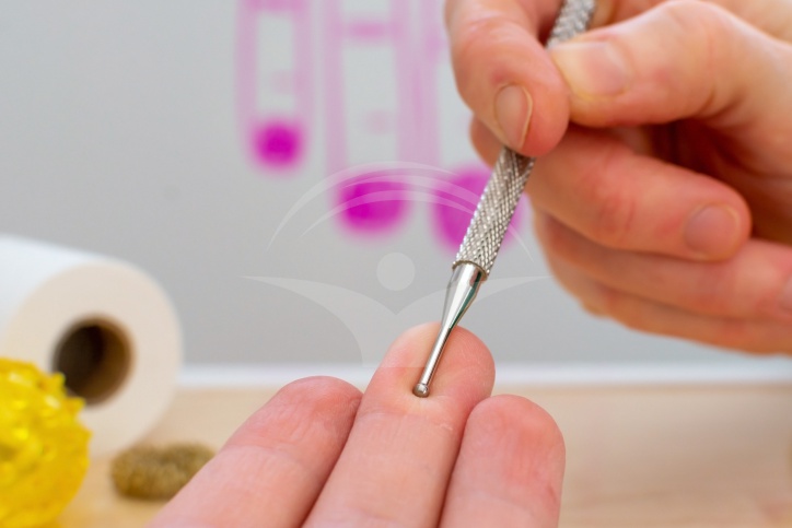 Sensibilitate crescuta la stimuli