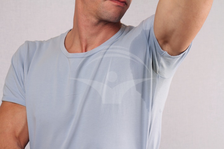 Transpiratie excesiva