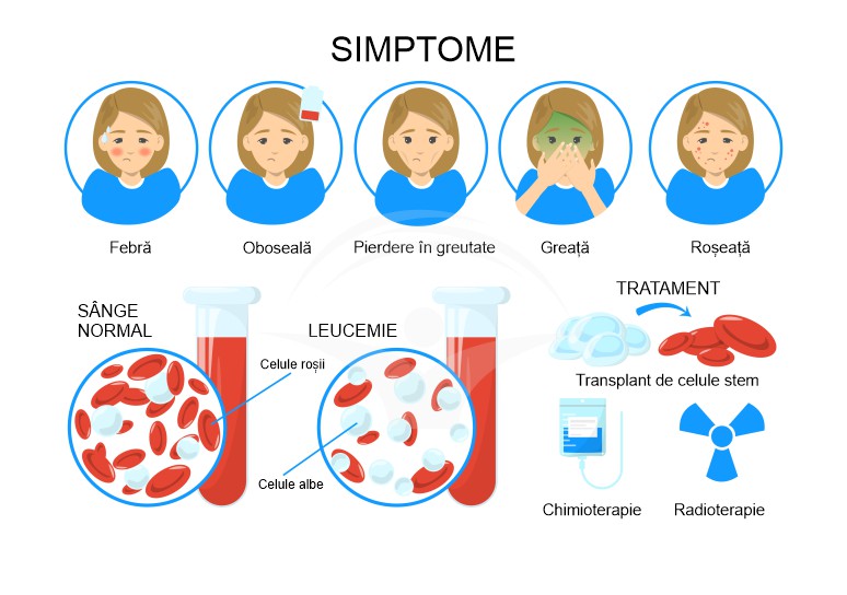 Leucemia: clasificare, cauze si tratament