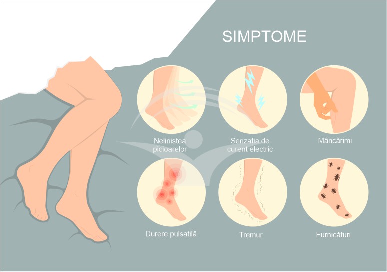 Sindromul picioarelor nelinistite (boala Willis Ekbom): cauze, simptome si tratament