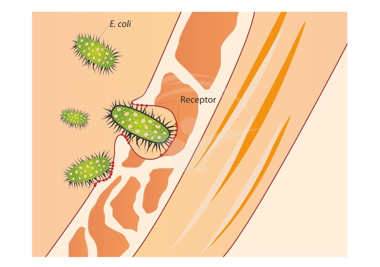 Ce trebuie sa stii despre infectia cu E. coli
