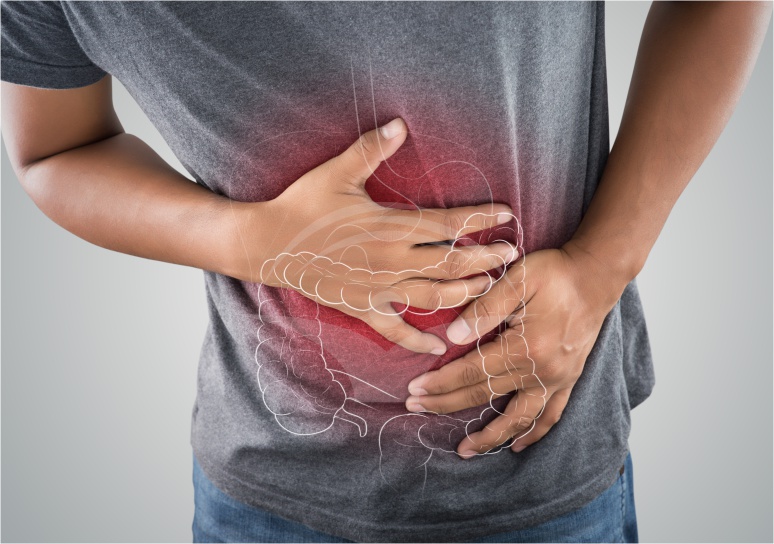 Tumorile de colon drept: ce sunt si cum pot fi tratate?