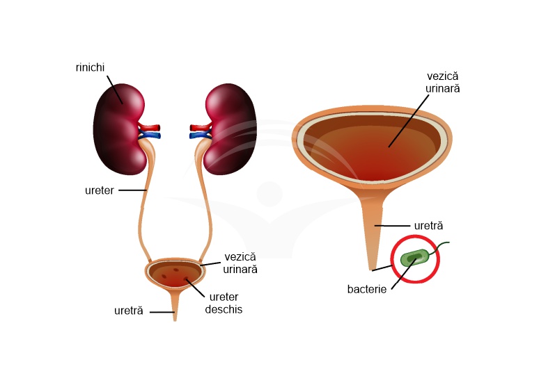 infecţie urinara simptome magnet de la prostatită