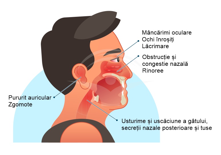 Rinita alergica: cauze, simptome si tratament | alexandrudiaconescu.ro