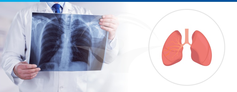 Tuberculoza: Factori de risc, diagnostic, tratament, preventie | Bioclinica