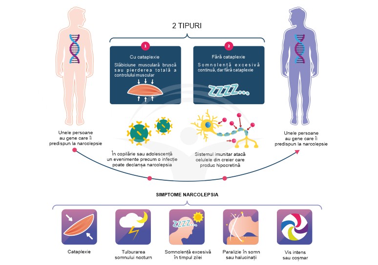 Narcolepsia: cauze, simptome si tratament