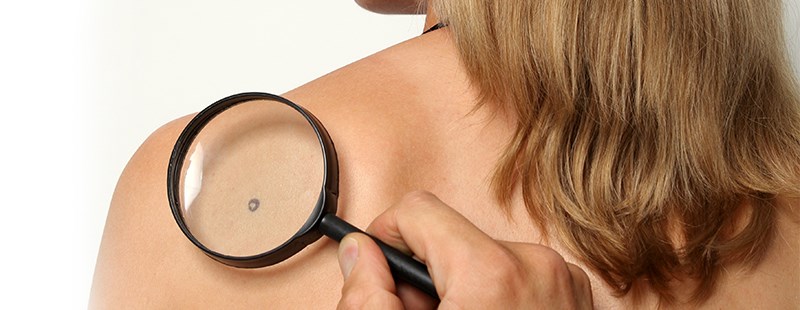 alunite ingrijoratoare