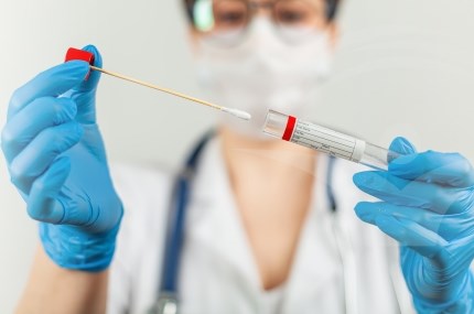 RT PCR multiplex, testul care face diferenta intre COVID-19 si gripa sezoniera!