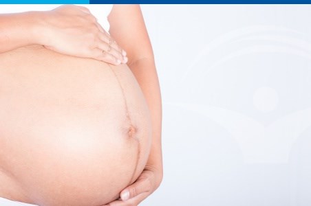 Trei mituri legate de linea nigra si sarcina