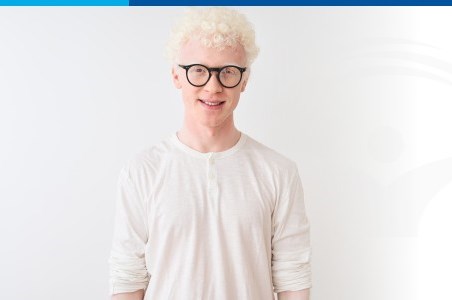 Albinismul: cauze, simptome si diagnostic