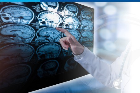 Scleroza multipla: cauze, simptome si tratament