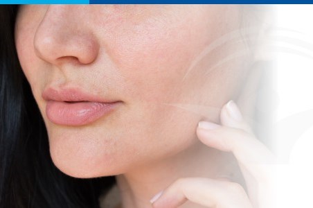 Sindromul Sjogren: cauze, simptome si tratament