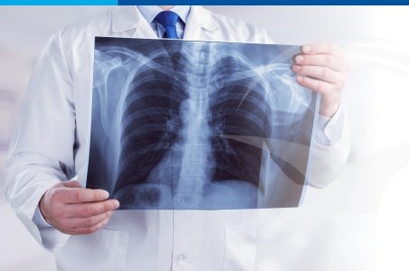 Tuberculoza - simptome, investigatii, metode de tratament