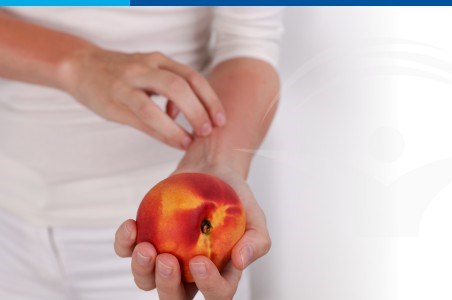 Alergia alimentara: cauze, simptome si tratament