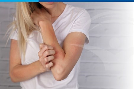 Eczema: forme clinice, cauze si tratament