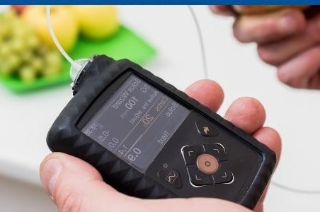 Pompa de insulina si dispozitivul de monitorizare continua a&nbsp;glicemiei la pacientii cu diabet zaharat de tip 1