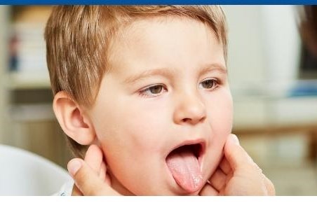 Boala gura-mana-picior: cauze, manifestari, tratament