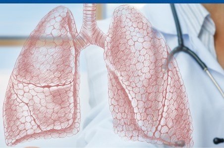 Pleurezia sau “apa la plamani” – cauze simptome si tratament