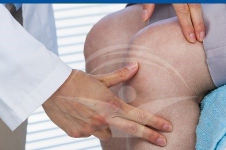 Revizia protezei de genunchi | Interventie realizata cu succes in Spitalul Medicover