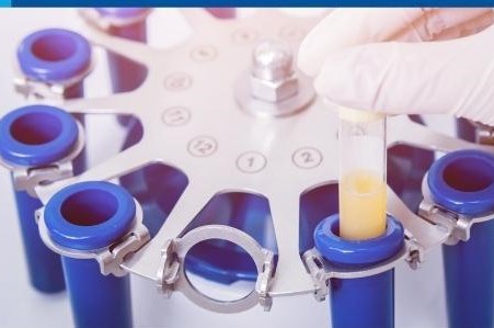 Terapia cu plasma imbogatita cu trombocite - PRP in ginecologia regenerativa