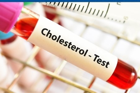 Colesterol LDL si HDL | Riscuri si tratament colesterol marit