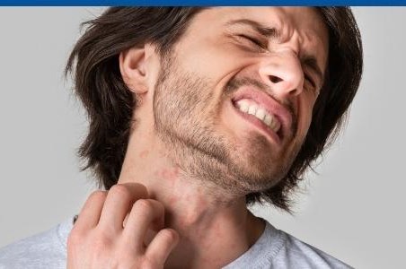 Dermatita de contact: cauze, simptome si tratament