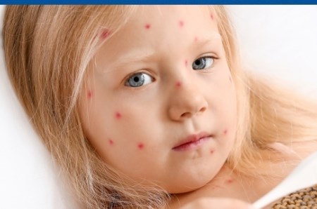 Bolile copilariei: cauze, simptome si evolutie