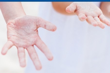 Paraziti intestinali la copii | Oxiuri, Giardia, Ascaris