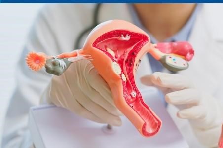 Optiuni de tratament cancer de col uterin in functie de stadiul tumorii