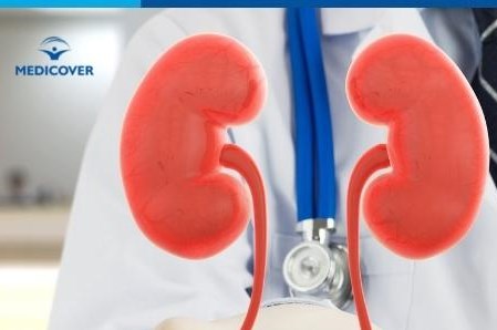 Pietre la rinichi (nefrolitiaza): simptome, cauze si tratament