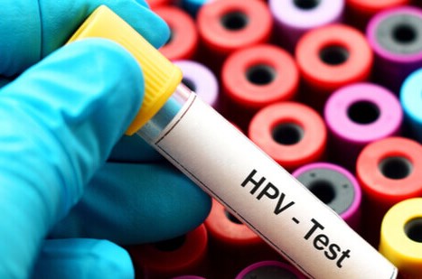 Importanta testului HPV in depistarea cancerului de col uterin