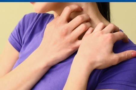 Pruritul in afectiunile dermatologice, infectii si alergii