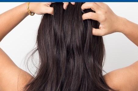 Matreata – cauze si tratament dermatologic