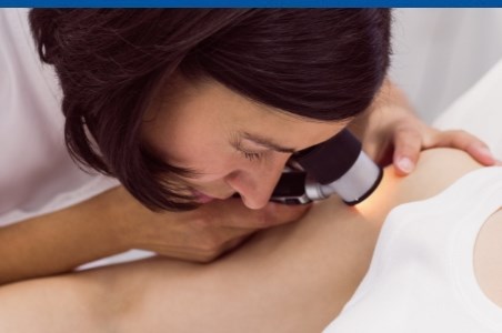 Pitiriazis versicolor: factori de risc si tratament