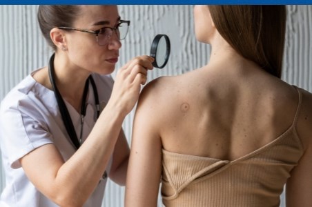 Cancer de piele: cauze, diagnostic si tratament