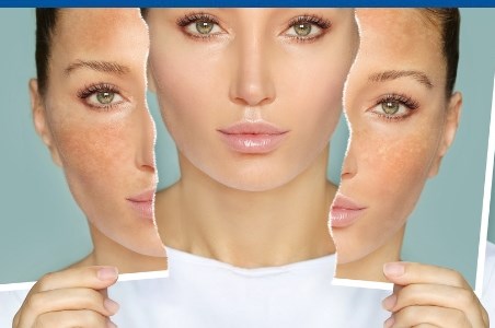 Legatura dintre alimentatie si cele mai frecvente afectiuni dermatologice