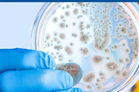 Impetigo - bube dulci: cai de transmitere si tratament