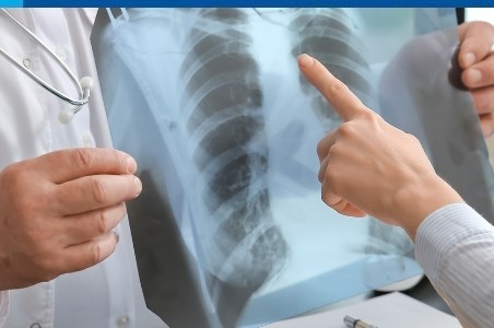 Sarcoidoza – ce este si cum poate fi tratata