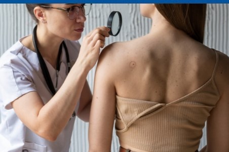 Alunitele: monitorizarea si indepartarea chirurgicala