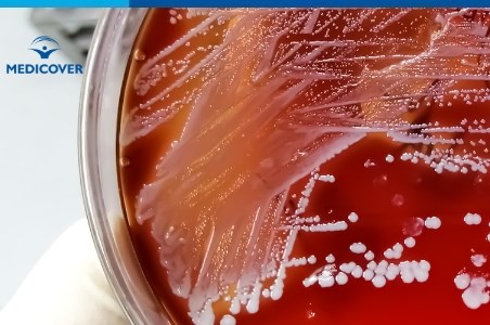 Stafilococul auriu: semne ale infectiei, diagnostic si tratament