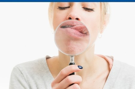 Limba geografica: cauze, manifestari, tratament