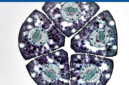 Autofagie: scurt ghid pe intelesul tuturor