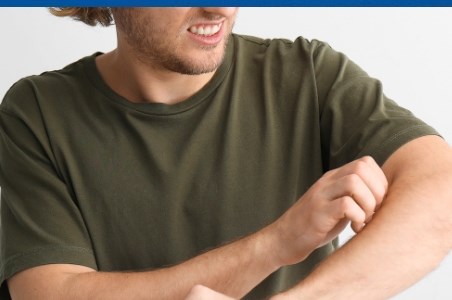 Eritemul nodos: cauze, simptome, diagnostic si tratament