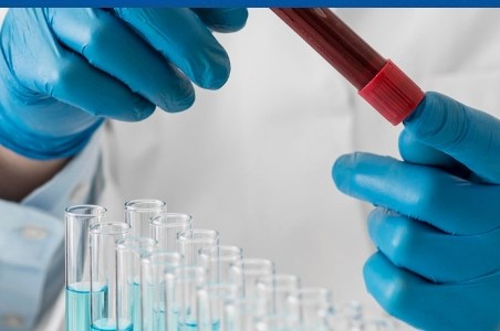 Talasemie: cauze, simptome, diagnostic si tratament