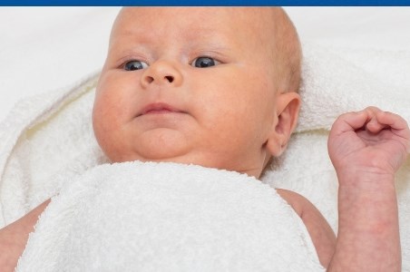 Icterul la bebelusi: ghid complet pentru parinti