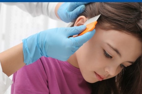 Pediculoza si paduchii de scalp la copii