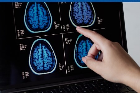 Meningiom: cauze, simptome, diagnostic si tratament